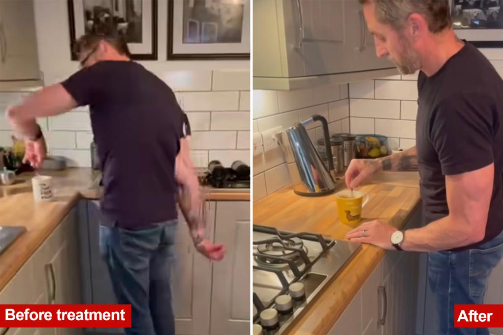 Parkinson's drug Produodopa gives UK dad Damien Gath life-changing before and after video